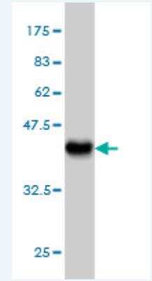 Western Blot: VARS Antibody (4B7) [H00007407-M01]