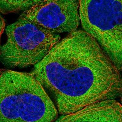 Immunocytochemistry/ Immunofluorescence: VARS Antibody [NBP2-13513]