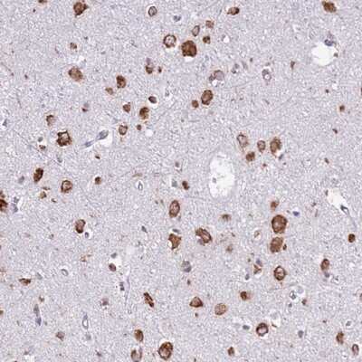 Immunohistochemistry-Paraffin: VARS Antibody [NBP2-13513]