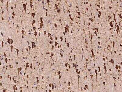 Immunohistochemistry-Paraffin: VARS Antibody [NBP3-05970]