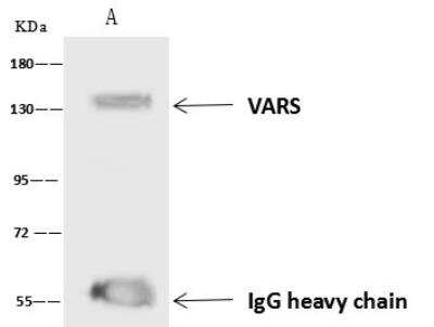 Immunoprecipitation: VARS Antibody [NBP3-05970]