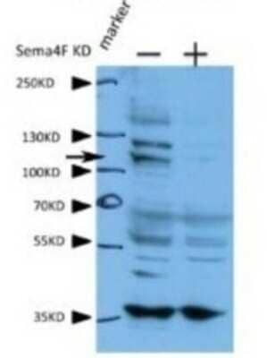 Western Blot: VARS Antibody [NBP1-55366]