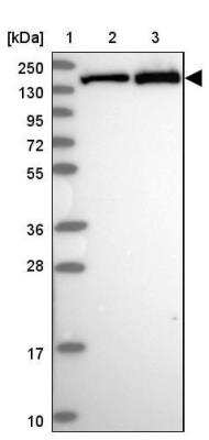 Western Blot: VARS Antibody [NBP2-13513]