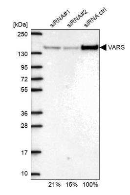 Western Blot: VARS Antibody [NBP2-13513]