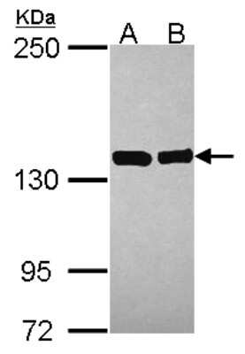 Western Blot: VARS Antibody [NBP2-20843]