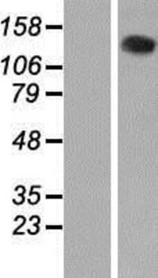 Western Blot: VARS Overexpression Lysate [NBP2-07645]