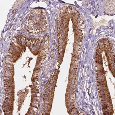 Immunohistochemistry: VARS2 Antibody [NBP2-49627]