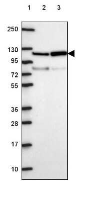 Western Blot: VARS2 Antibody [NBP2-49627]