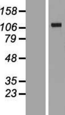 Western Blot: VARS2 Overexpression Lysate [NBL1-17696]