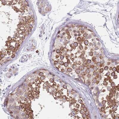 Immunohistochemistry-Paraffin: VASA Antibody [NBP2-13907]