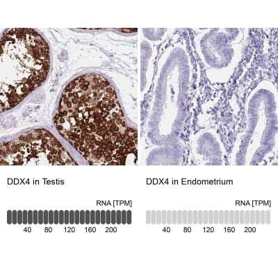 Immunohistochemistry-Paraffin: VASA Antibody [NBP2-13908]