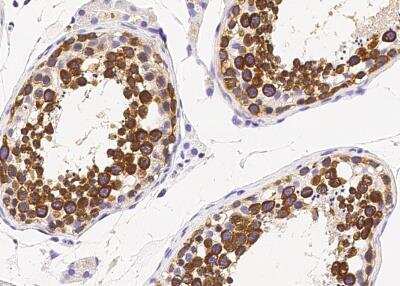 Immunohistochemistry-Paraffin: VASA Antibody [NBP2-95280]