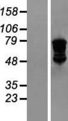 Western Blot: VASA Overexpression Lysate [NBL1-09796]