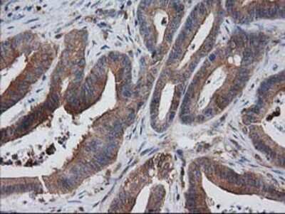 Immunohistochemistry-Paraffin: VASP Antibody (OTI4D6) [NBP2-00555]