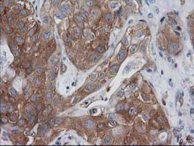 Immunohistochemistry-Paraffin: VASP Antibody (OTI4D6) [NBP2-00555]