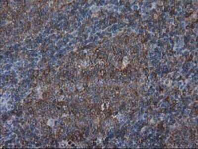 Immunohistochemistry-Paraffin: VASP Antibody (OTI4D6) [NBP2-00555]