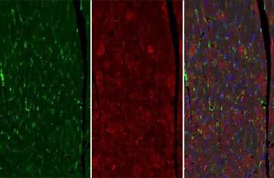 Immunohistochemistry-Paraffin: VASP Antibody (GT238) [NBP3-13619]