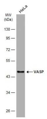 Western Blot: VASP Antibody (GT238) [NBP3-13619]