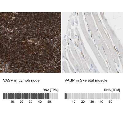 Immunohistochemistry-Paraffin: VASP Antibody [NBP1-85792]