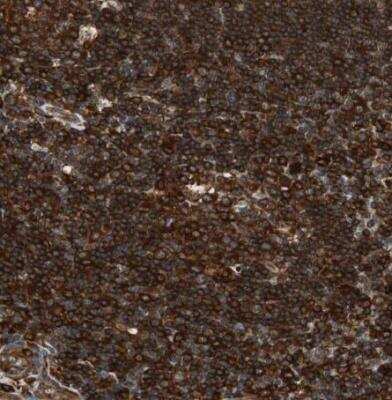 Immunohistochemistry-Paraffin: VASP Antibody [NBP1-85792]