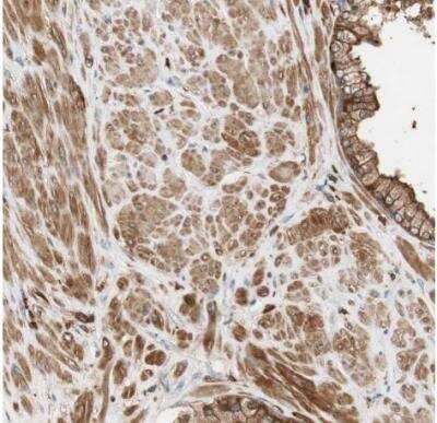 Immunohistochemistry-Paraffin: VASP Antibody [NBP1-85792]