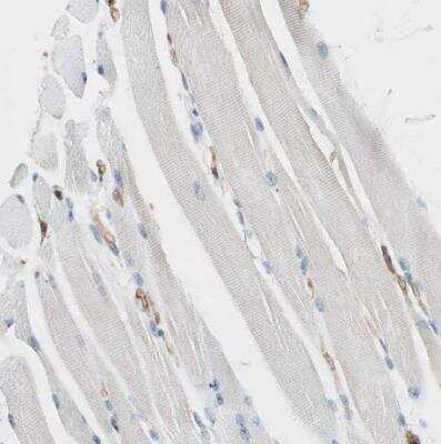 Immunohistochemistry-Paraffin: VASP Antibody [NBP1-85792]