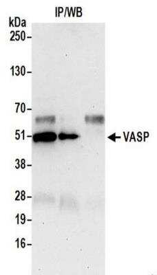 Immunoprecipitation: VASP Antibody [NBP2-41363]