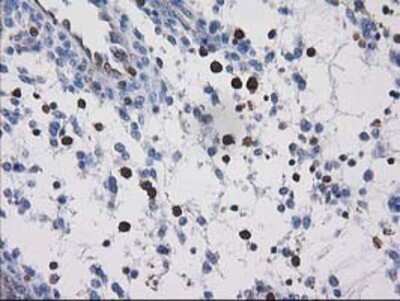Immunohistochemistry: VASP Antibody (OTI4D6) - Azide and BSA Free [NBP2-74830]