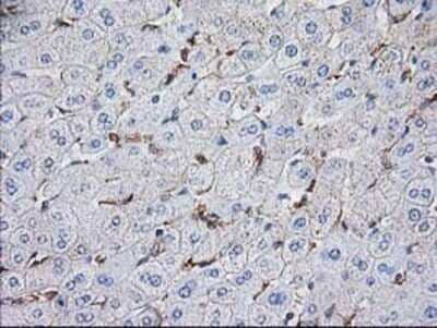 Immunohistochemistry: VASP Antibody (OTI4D6) - Azide and BSA Free [NBP2-74830]