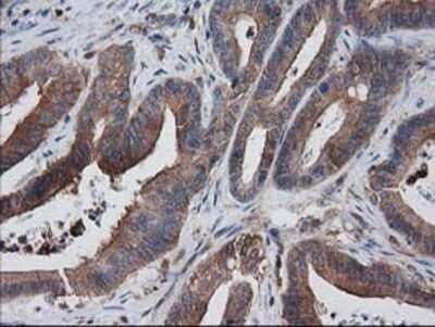 Immunohistochemistry: VASP Antibody (OTI4D6) - Azide and BSA Free [NBP2-74830]