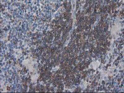 Immunohistochemistry: VASP Antibody (OTI4D6) - Azide and BSA Free [NBP2-74830]