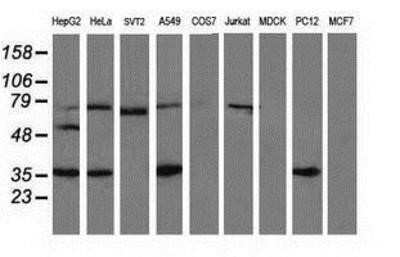 Western Blot: VASP Antibody (OTI4D6)Azide and BSA Free [NBP2-74830]