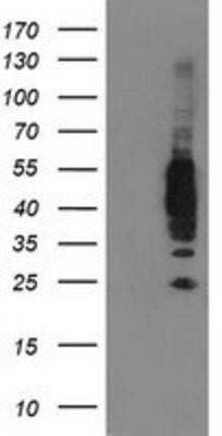 Western Blot: VASP Antibody (OTI4D6)Azide and BSA Free [NBP2-74830]