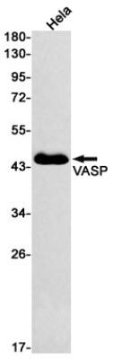 Western Blot: VASP Antibody (S04-2B0) [NBP3-19801]