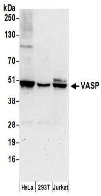 Western Blot: VASP Antibody [NBP2-41363]