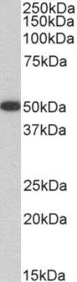 Western Blot: VASP Antibody [NBP2-42515]