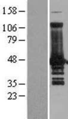 Western Blot: VASP Overexpression Lysate [NBL1-17699]