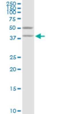 Western Blot: VAT1 Antibody (3E9) [H00010493-M07]