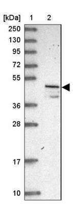 Western Blot: VAT1 Antibody [NBP1-92569]