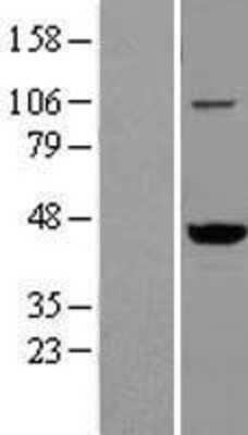 Western Blot: VAT1 Overexpression Lysate [NBL1-17700]