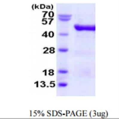 SDS-PAGE: Recombinant Human VAT1 His Protein [NBP1-78838]