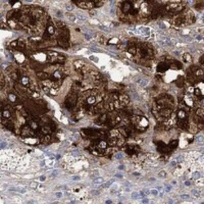 Immunohistochemistry-Paraffin: VAT1L Antibody [NBP3-17071]