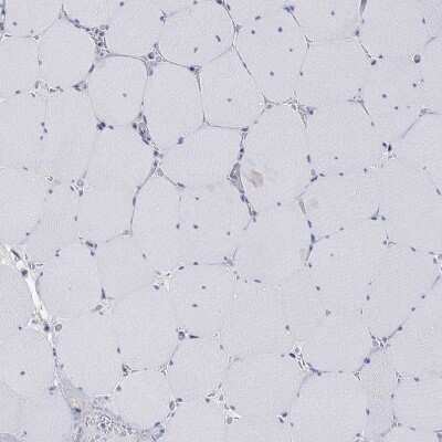 Immunohistochemistry-Paraffin: VAT1L Antibody [NBP3-17071]