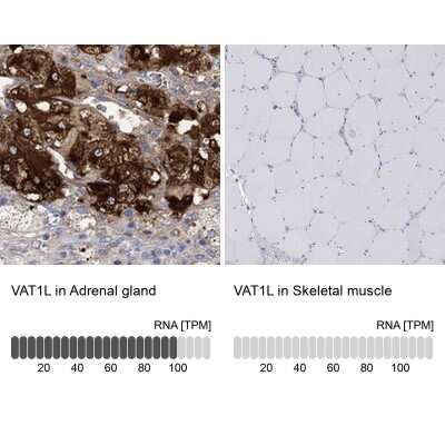 Immunohistochemistry-Paraffin: VAT1L Antibody [NBP3-17071]