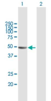 Western Blot: VAT1L Antibody [H00057687-B01P]