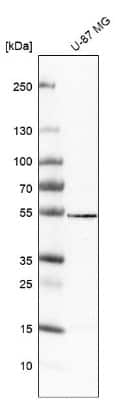 Western Blot: VAT1L Antibody [NBP1-92570]