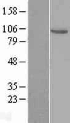 Western Blot: Vav-1 Overexpression Lysate [NBL1-17701]