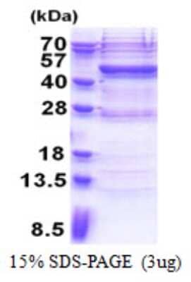 SDS-PAGE: Recombinant Human Vav-1 His Protein [NBP2-22938]