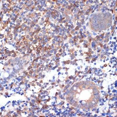 Immunohistochemistry-Paraffin: VAV2 Antibody (3S0O9) [NBP3-16218]