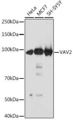 Western Blot: VAV2 Antibody (3S0O9) [NBP3-16218]